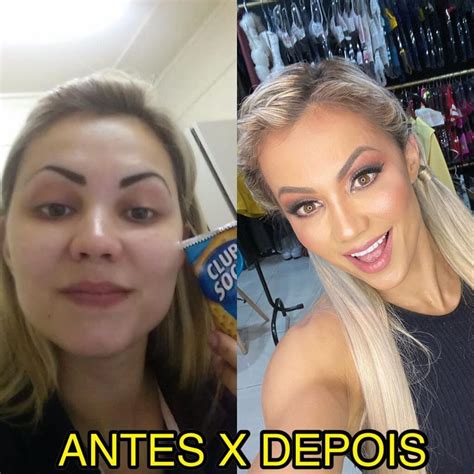 Vivi Winkler: Antes e Depois 